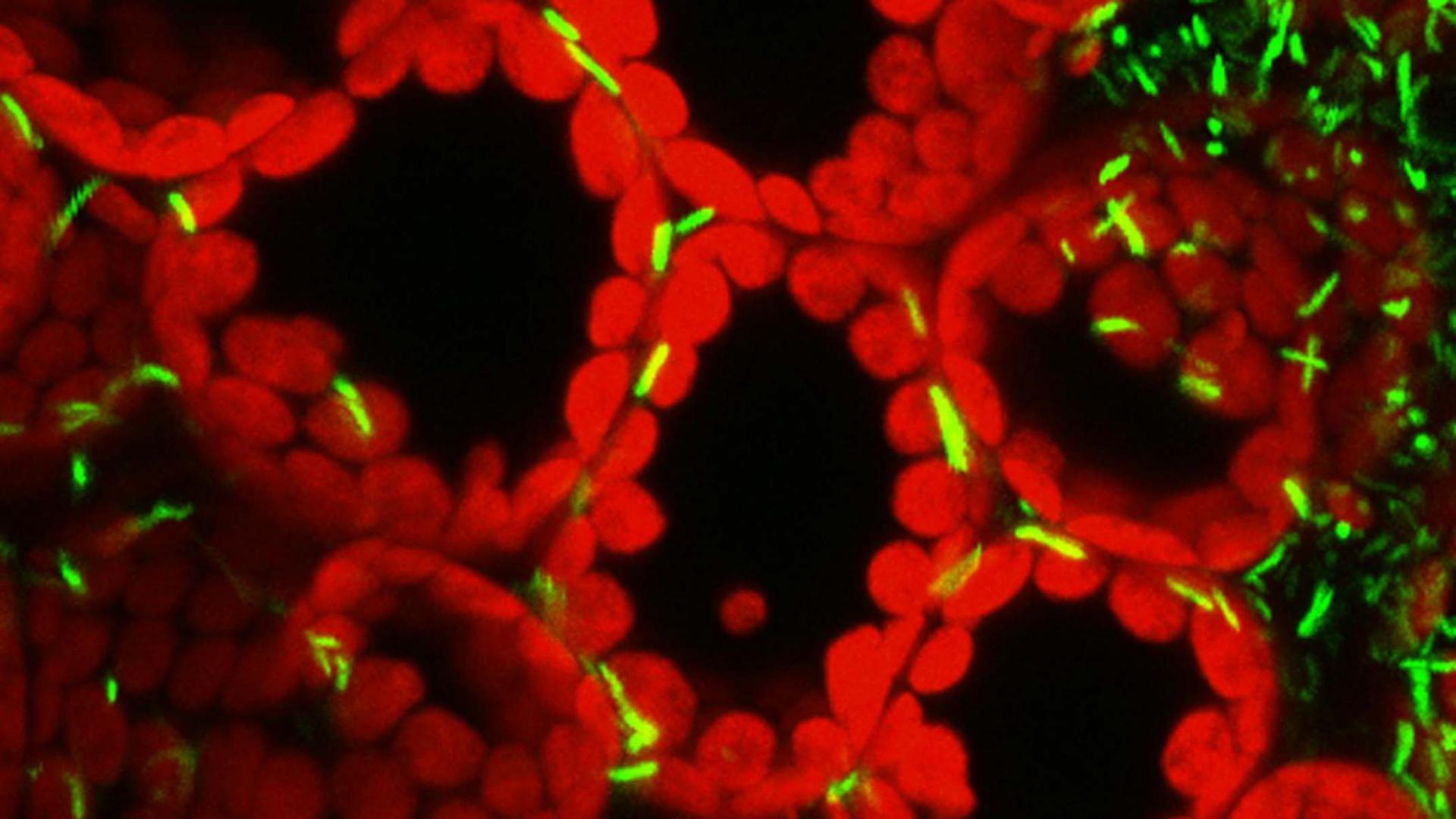 Plant Cells in red and green.