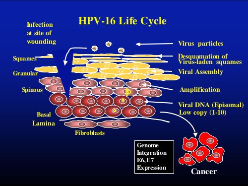 A HPV-fertőzés tünetei nőkben és férfiakban